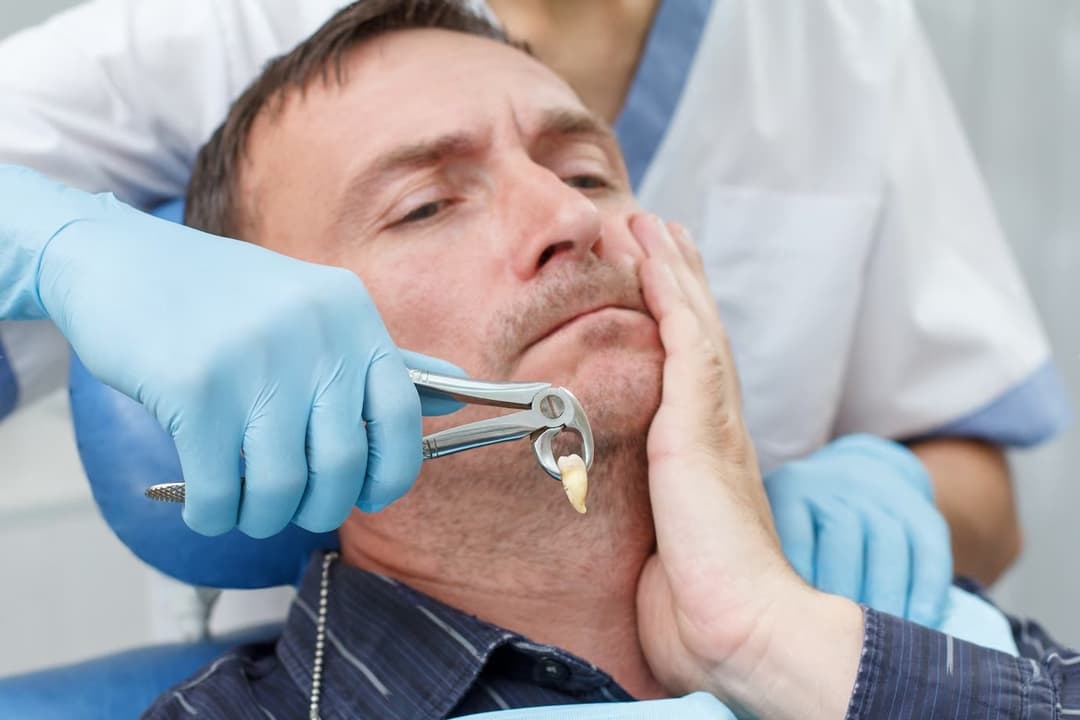 Wisdom Tooth Removal