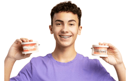 Braces vs Invisalign