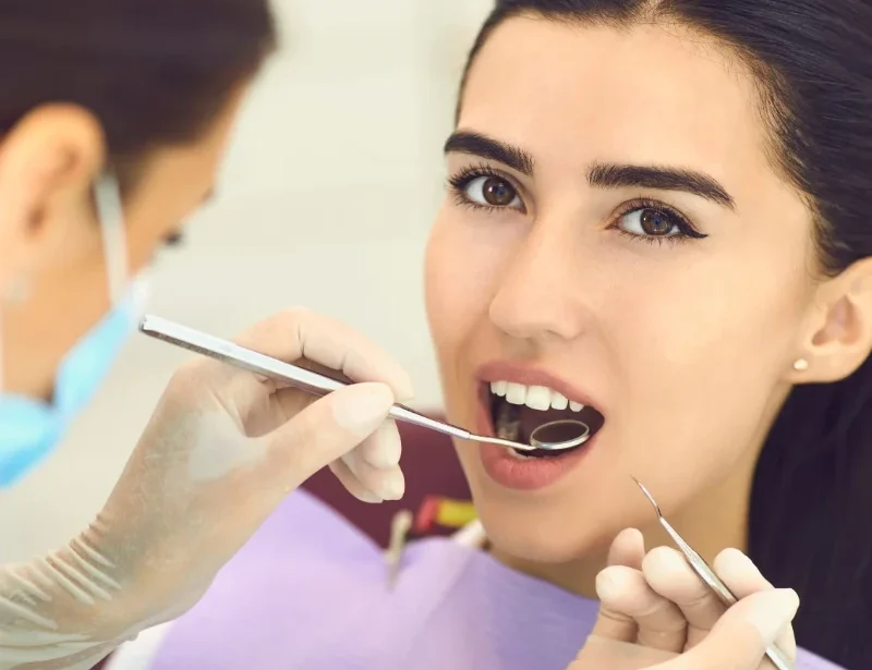 Root-Canals-services