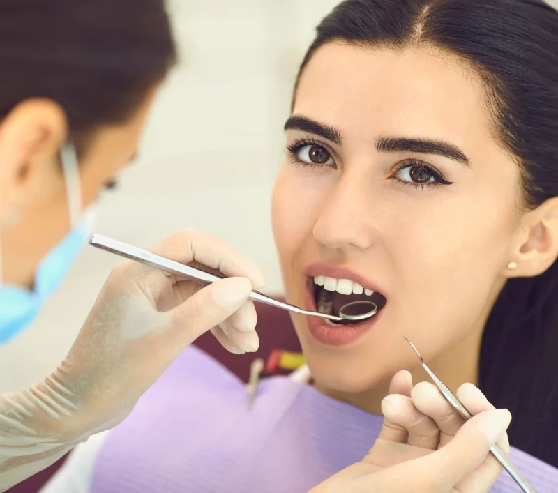 Root-Canals-services